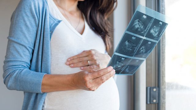 Viên chức có phải thực hiện biệt phái trong thời gian mang thai – luật 24h